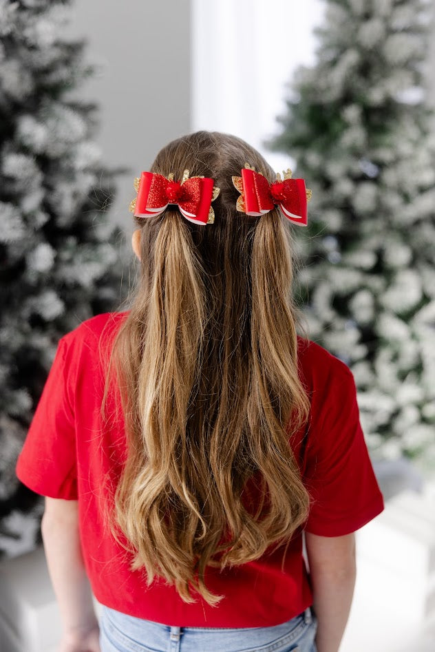 Red-Nose Sparkle Hair Bow Set